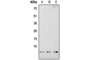 Western blot analysis of RBBP6 expression in HEK293T (A), Raw264. (RBBP6 antibody  (Center))