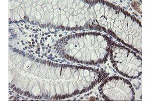 Image no. 2 for anti-Replication Factor C (Activator 1) 2, 40kDa (RFC2) (AA 1-234) antibody (ABIN1490616) (RFC2 antibody  (AA 1-234))