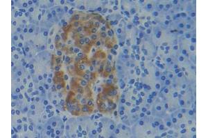 DAB staining on IHC-P; Samples: Human Pancreas Tissue (APRT antibody  (AA 1-180))