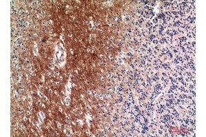 Immunohistochemistry (IHC) analysis of paraffin-embedded Human Brain, antibody was diluted at 1:100. (Complement C4A/C4B (Internal Region) antibody)