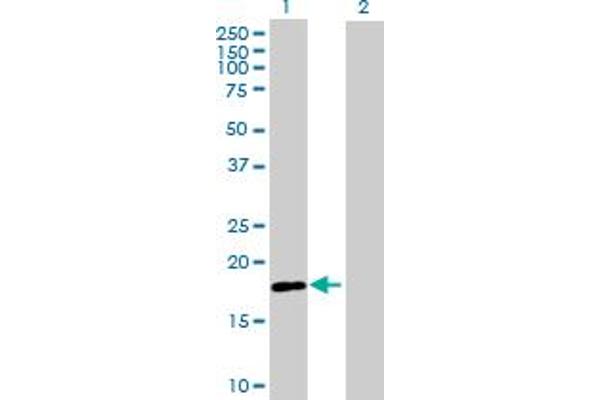 RNF170 anticorps  (AA 1-200)