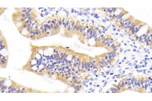 Detection of RBP2 in Human Small intestine Tissue using Monoclonal Antibody to Retinol Binding Protein 2, Cellular (RBP2) (RBP2 antibody  (AA 1-134))