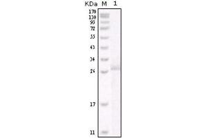 Western Blotting (WB) image for anti-Receptor tyrosine-protein kinase erbB-2 (ErbB2/Her2) antibody (ABIN2843749) (ErbB2/Her2 antibody)