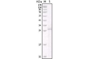 Western Blotting (WB) image for anti-Receptor tyrosine-protein kinase erbB-2 (ErbB2/Her2) antibody (ABIN1845273) (ErbB2/Her2 antibody)