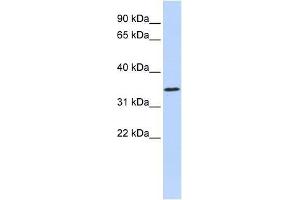 ZNF660 antibody used at 0. (ZNF660 antibody  (N-Term))