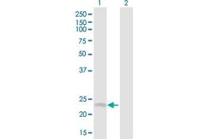 Western Blot analysis of SRD5A1 expression in transfected 293T cell line by SRD5A1 MaxPab polyclonal antibody. (SRD5A1 antibody  (AA 1-259))