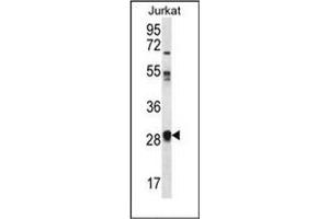 Western blot analysis of OR11L1 Antibody (C-term) in Jurkat cell line lysates (35ug/lane). (OR11L1 antibody  (C-Term))