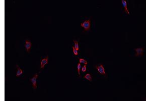 ABIN6276744 staining HepG2? (ABO antibody  (N-Term))