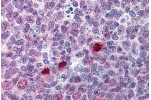 Human Tonsil, Mitotic Figures: Formalin-Fixed, Paraffin-Embedded (FFPE) (Separase antibody  (AA 586-702))