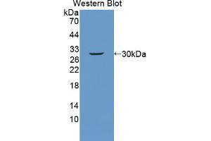 Figure. (PLXNB1 antibody  (AA 1598-1849))