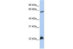 WB Suggested Anti-MGRN1 Antibody Titration:  0. (Mahogunin RING Finger Protein 1 antibody  (Middle Region))