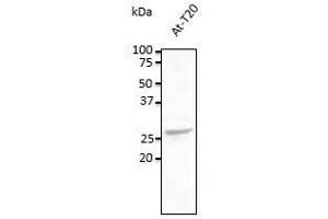 Anti-Rab5c Ab at 1/500 dilution, lysates at 100 µg per Iane, rabbit polyclonal to goat lgG (HRP) at 1/10,000 dilution, (Rab5c antibody  (C-Term))