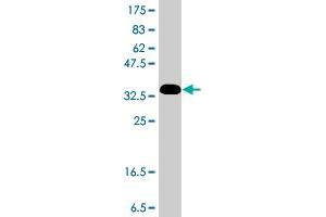 Western Blot detection against Immunogen (36. (NBR1 antibody  (AA 2-96))