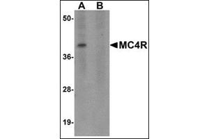 Western blot analysis of MC4R in rat brain tissue lysate with this product at 1 μg/ml in (A) the absence and (B) the presence of blocking peptide.