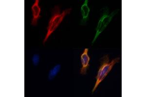 ABIN6265092 and ABIN6268681 staining Hela by IF/ICC. (SIRT3 antibody  (C-Term))