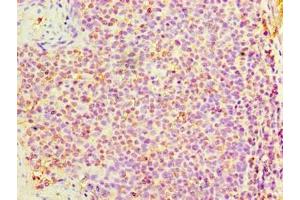 Immunohistochemistry of paraffin-embedded human tonsil tissue using ABIN7150869 at dilution of 1:100 (DNAH3 antibody  (AA 1-150))