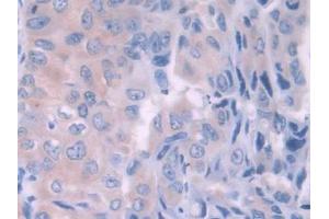 Used in DAB staining on fromalin fixed paraffin- embedded kidney tissue (HFE2 antibody  (AA 234-416))