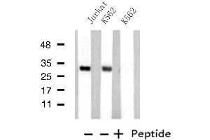 Western blot analysis of extracts from Jurkat/K562 cells, using MED8 antibody. (MED8 antibody  (C-Term))