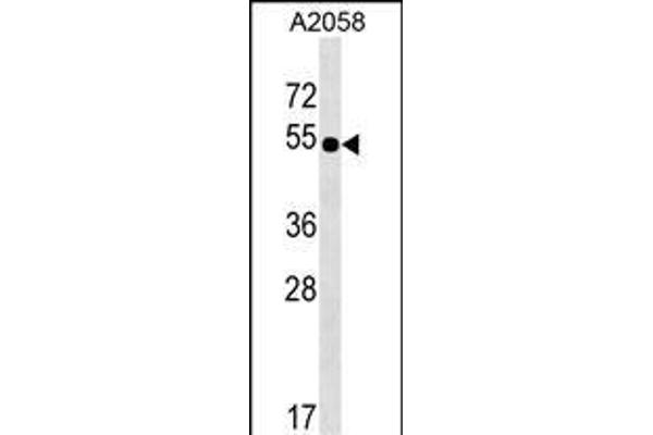 NHEDC2 antibody  (C-Term)