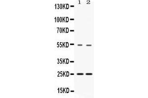 Western blot analysis of SYBL1 expression in rat liver extract ( Lane 1) and HELA whole cell lysates ( Lane 3).