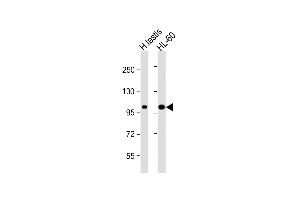 All lanes : Anti-SENP6 Antibody  at 1:1000 dilution Lane 1: human testis lysate Lane 2: HL-60 whole cell lysate Lysates/proteins at 20 μg per lane. (SENP6 antibody  (C-Term))