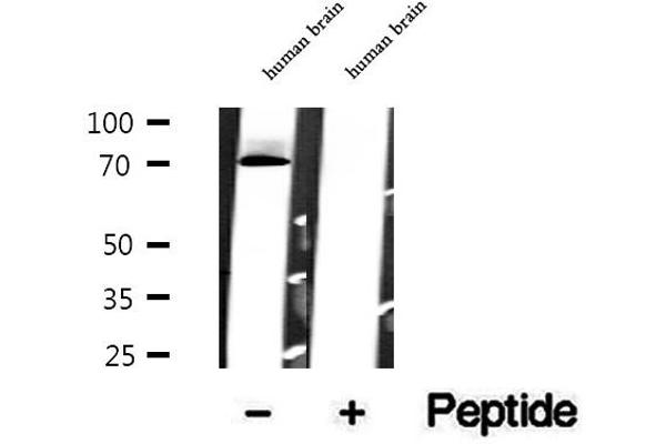 BBS7 antibody  (Internal Region)