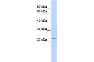WB Suggested Anti-RP11-529I10. (DPCD antibody  (N-Term))