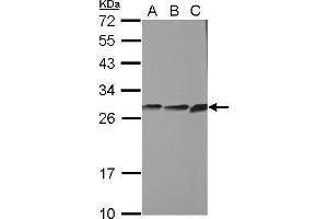WB Image Sample (30 ug of whole cell lysate) A: PC-3 B: U87-MG C: SK-N-SH 12% SDS PAGE antibody diluted at 1:1000 (CYB5R2 antibody)
