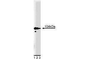 Western blot analysis of Adaptin gamma on PC12 cell lysate. (gamma 1 Adaptin antibody  (AA 642-821))