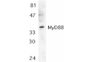 Image no. 1 for anti-Myeloid Differentiation Primary Response Gene (88) (MYD88) (AA 279-296), (C-Term) antibody (ABIN205874) (MYD88 antibody  (C-Term))