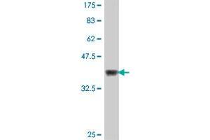 Western Blot detection against Immunogen (37. (NR4A3 antibody  (AA 414-521))