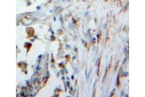 Used in DAB staining on fromalin fixed paraffin-embedded lung tissue (WFDC1 antibody  (AA 24-208))