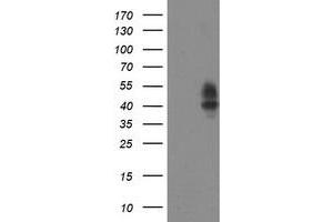 HEK293T cells were transfected with the pCMV6-ENTRY control (Left lane) or pCMV6-ENTRY LRRC25 (Right lane) cDNA for 48 hrs and lysed. (LRRC25 antibody)