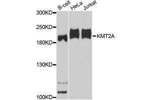 Western blot analysis of extracts of various cell lines, using KMT2A antibody. (MLL/KMT2A antibody)