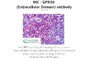Image no. 1 for anti-G Protein-Coupled Estrogen Receptor 1 (GPER) (2nd Extracellular Domain) antibody (ABIN1735051) (GPER antibody  (2nd Extracellular Domain))