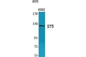 Western Blot (WB) analysis of specific cells using ST5 Polyclonal Antibody.