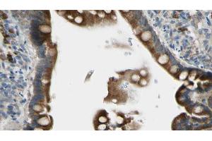 ABIN6268678 at 1/100 staining Mouse intestine tissue by IHC-P. (GJB1 antibody  (Internal Region))