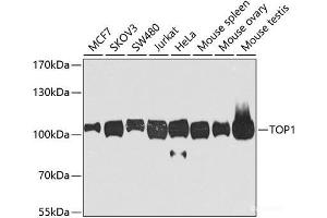 Western blot analysis of extracts of various cell lines using TOP1 Polyclonal Antibody at dilution of 1:1000. (Topoisomerase I antibody)