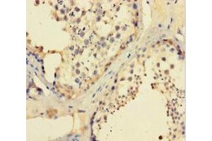 Immunohistochemistry of paraffin-embedded human testis tissue using ABIN7156529 at dilution of 1:100 (CCDC36 antibody  (AA 11-592))