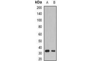 Western blot analysis of SSX5 expression in Raji (A), mouse skeletal muscle (B) whole cell lysates.
