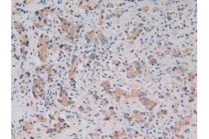 Figure. (Kallikrein 2 antibody  (AA 19-261))