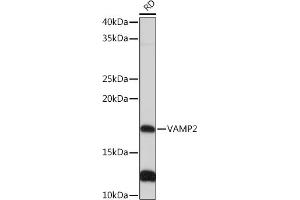 Western blot analysis of extracts of RD cells, using V Rabbit mAb (ABIN7271313) at 1:1000 dilution. (VAMP2 antibody)