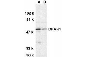 Western blot analysis of DRAK1 in (A) MOLT4 and (B) A431 whole cell lysates with AP30302PU-N DRAK1 antibody at 1 μg/ml. (STK17A antibody  (N-Term))