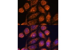 Immunofluorescence analysis of HeLa cells using MTMR9 antibody (ABIN6128253, ABIN6144163, ABIN6144164 and ABIN6217000) at dilution of 1:100. (MTMR9 antibody  (AA 1-250))