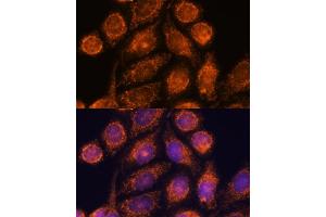 Immunofluorescence analysis of HeLa cells using MTMR9 antibody (ABIN6128253, ABIN6144163, ABIN6144164 and ABIN6217000) at dilution of 1:100. (MTMR9 antibody  (AA 1-250))