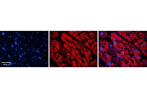Rabbit Anti-ECM1 Antibody   Formalin Fixed Paraffin Embedded Tissue: Human heart Tissue Observed Staining: Cytoplasmic Primary Antibody Concentration: N/A Other Working Concentrations: 1:600 Secondary Antibody: Donkey anti-Rabbit-Cy3 Secondary Antibody Concentration: 1:200 Magnification: 20X Exposure Time: 0. (ECM1 antibody  (Middle Region))
