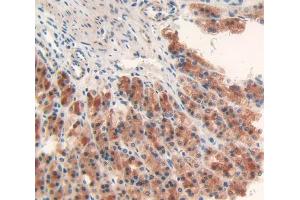 Used in DAB staining on fromalin fixed paraffin- embedded stomach tissue (Fatty Acid Synthase antibody  (AA 2243-2505))