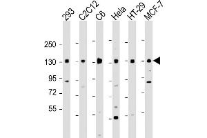 All lanes : Anti-MYPT1 Antibody at 1:2000 dilution Lane 1: 293 whole cell lysate Lane 2: C2C12 whole cell lysate Lane 3: C6 whole cell lysate Lane 4: Hela whole cell lysate Lane 5: HT-29 whole cell lysate Lane 5: MCF-7 whole cell lysate Lysates/proteins at 20 μg per lane. (PPP1R12A antibody  (AA 824-857))