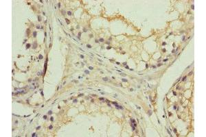 Immunohistochemistry of paraffin-embedded human testis tissue using ABIN7151092 at dilution of 1:100 (RNF41 antibody  (AA 1-317))