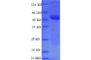 SDS-PAGE (SDS) image for Carbonic Anhydrase 12 (CA12) (AA 25-301), (Extracellular) protein (His-SUMO Tag) (ABIN5709175)